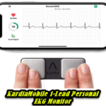 KardiaMobile personal EKG Monitor